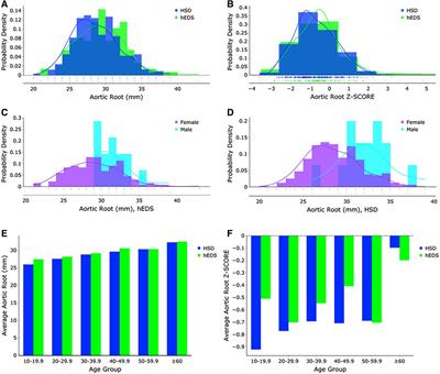 Cardiac defects of hypermobile Ehlers-Danlos syndrome and hypermobility spectrum disorders: a retrospective cohort study